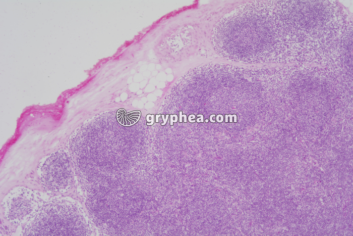 Thymus x20 - gryphea.org